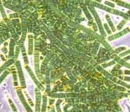 Datei:Bluegreen algae.jpg